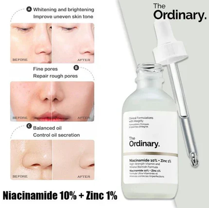 The Ordinary Niacinamide 10% + Zinc 1% Serum – 30ml High-strength Vitamin & Mineral Blemish Formula For Oil Control, Skin Brightening, And Clear, Radiant Complexion